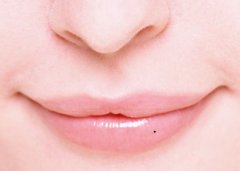 痣相图解:嘴角长痣好么