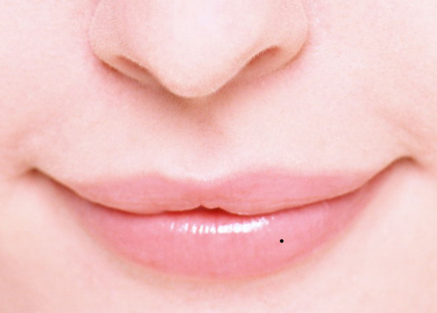 痣相图解:嘴角长痣好么