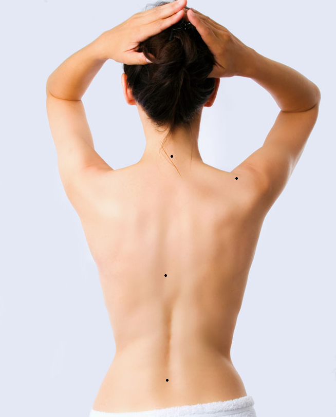 痣相图解:后背长痣好吗